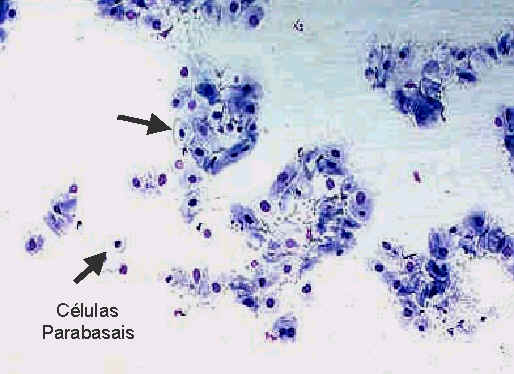 Células Parabasais