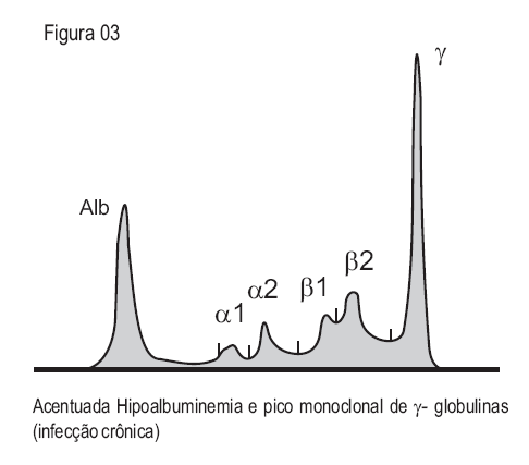 Infecção Crônica